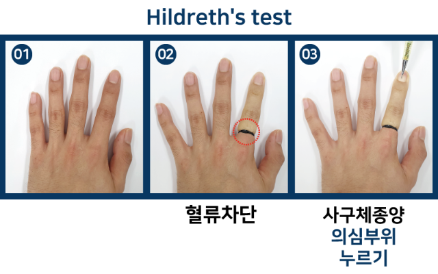 Hildreth's-test.png
