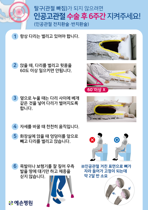 고관절 수술 후 실현 가능합니다.