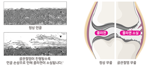 카티졸.png