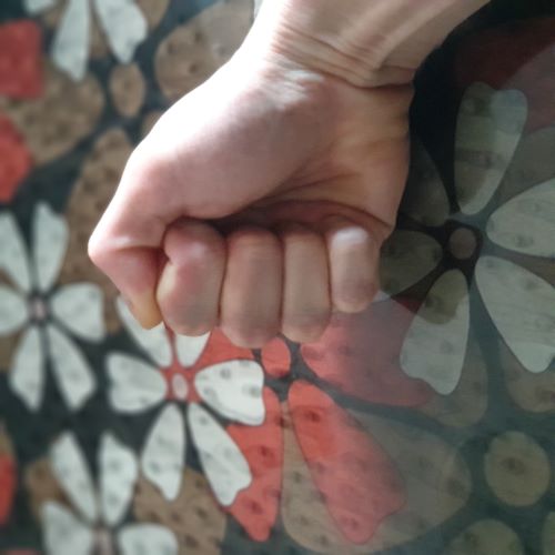 중지손가락 가운데마디 힘줄파열 - 전문의상담 중지손가락 가운데마디 힘줄파열 - 전문의상담